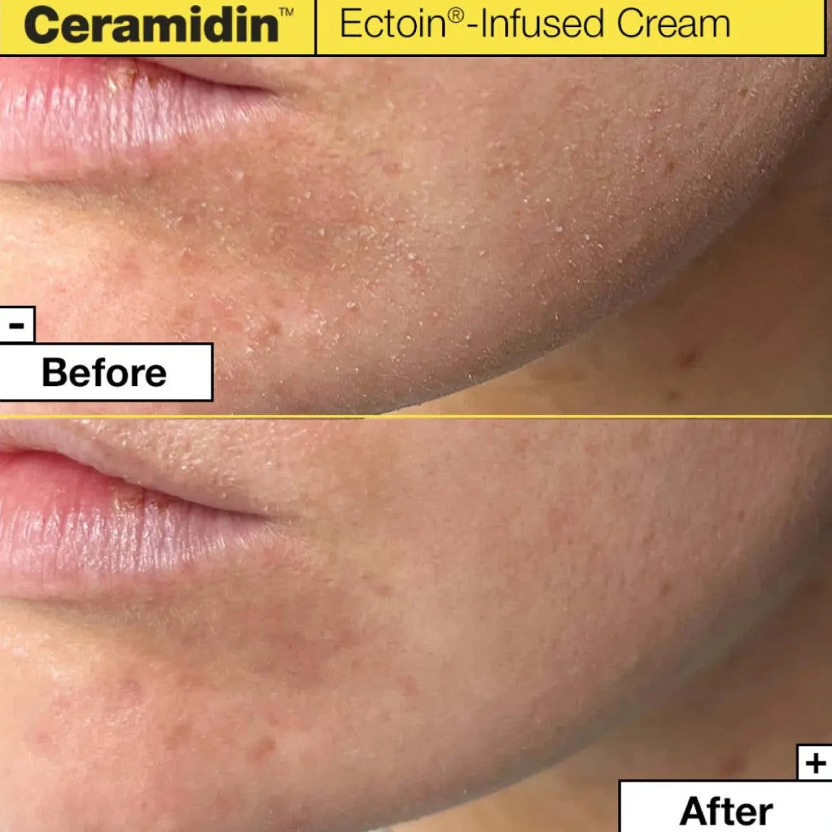 Ceramidin™ Ectoin-Infused Cream