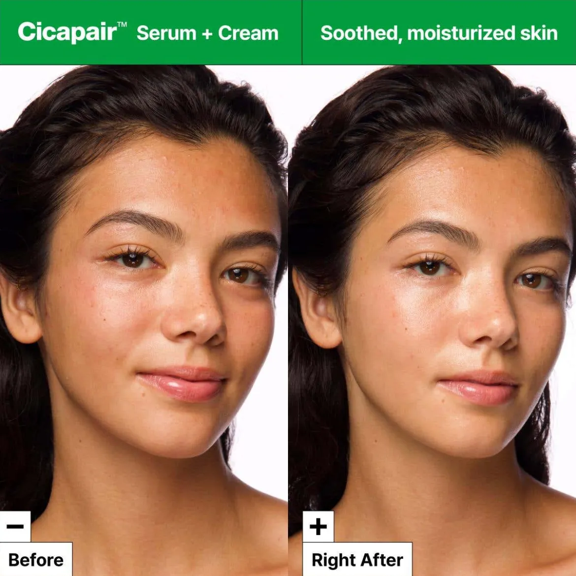Cicapair Intensive Soothing Repair Cream