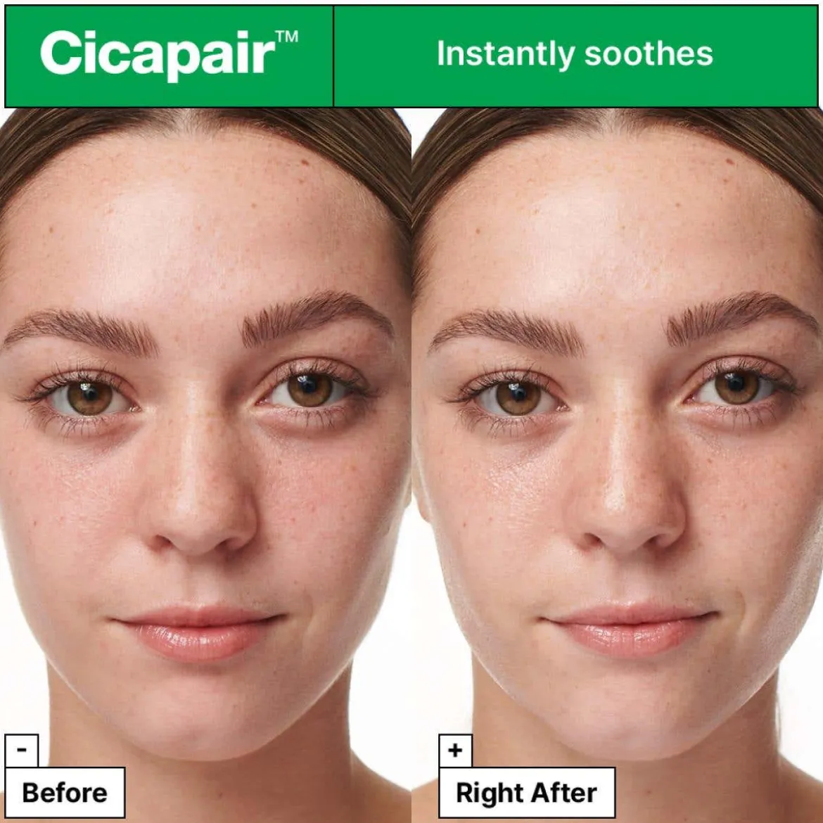 Cicapair Intensive Soothing Repair Serum