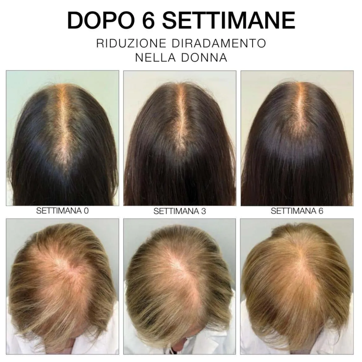 Estremirimedi Siero 6 Trattamento Fortificante scalpo & capelli
