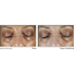 Even Tone + Lift Crema Contorno Occhi