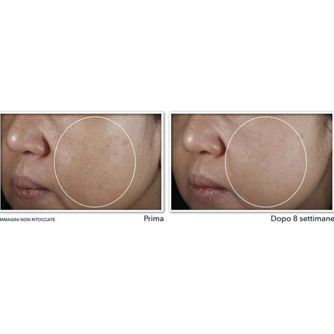 Even Tone + Lift Crema Notte