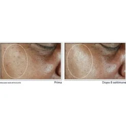 Even Tone + Lift Idratante Viso con SPF30