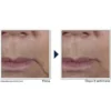 Firm + Lift Crema Viso