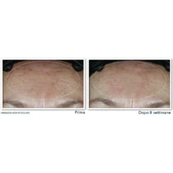 Hydrate + Plump Idratante Viso SPF 30