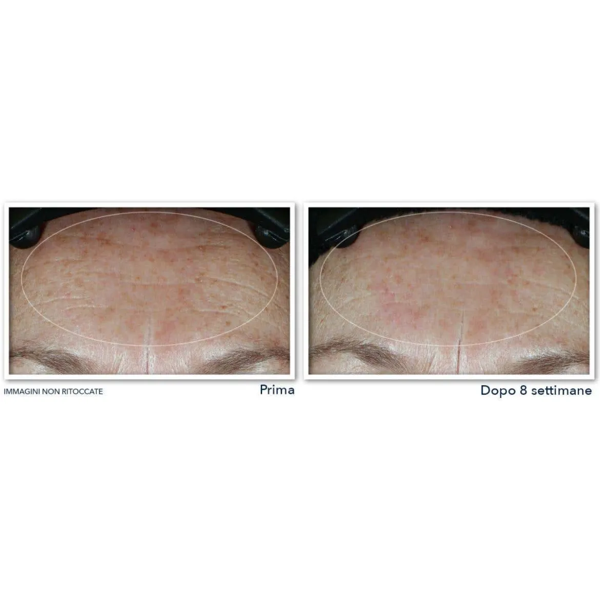 Hydrate + Plump Idratante Viso SPF 30