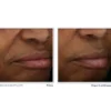 Revive + Glow Crema Viso Gel